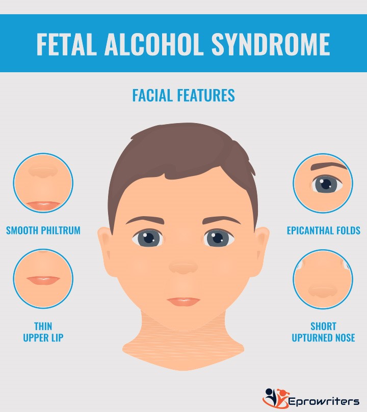Public Service Announcement: Fetal Alcohol Syndrome